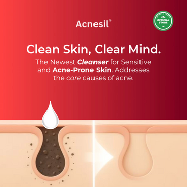 ACNESIL 2% Salicylic Acid Face Wash for Acne Prone and Sensitive Skin Treatment | 100ml