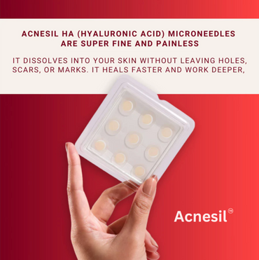 ACNESIL Microneedle Acne Pimple Patch | 9 Large Patches | Salicylic, Hyaluronic, Hydrocolloid