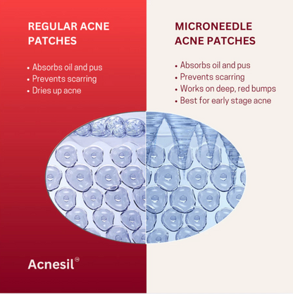 ACNESIL Microneedle Acne Pimple Patch | 9 Large Patches | Salicylic, Hyaluronic, Hydrocolloid