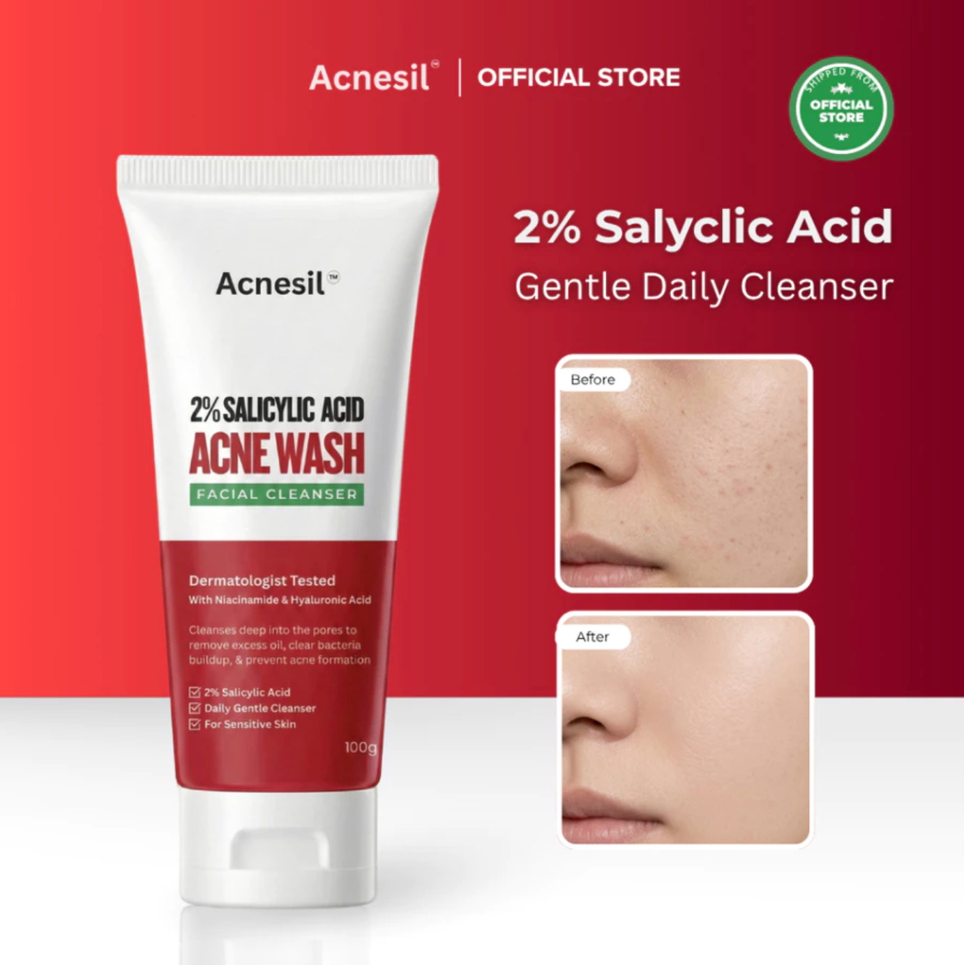 ACNESIL 2% Salicylic Acid Face Wash for Acne Prone and Sensitive Skin Treatment | 100ml
