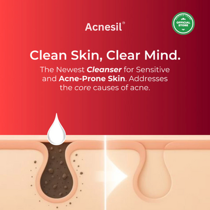 ACNESIL 2% Salicylic Acid Face Wash for Acne Prone and Sensitive Skin Treatment | 100ml